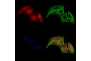 ABIN6265840 and ABIN6277615 staining Hela cells by IF/ICC.