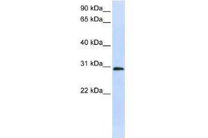 C6ORF21 antibody used at 1 ug/ml to detect target protein. (LY6G6F 抗体  (Middle Region))