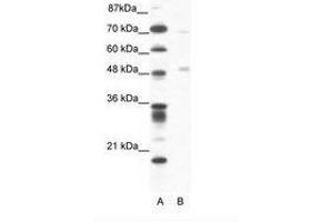 Image no. 1 for anti-Pancreatic Lipase (PNLIP) (AA 364-413) antibody (ABIN202588) (PNLIP 抗体  (AA 364-413))
