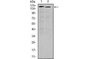 Western Blotting (WB) image for anti-Integrin alpha 4 (ITGA4) antibody (ABIN1106427) (ITGA4 抗体)