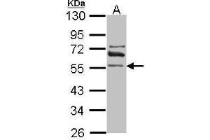 WB Image Sample (30 ug of whole cell lysate) A: IMR32 10% SDS PAGE antibody diluted at 1:1000 (ALDH1A2 抗体)
