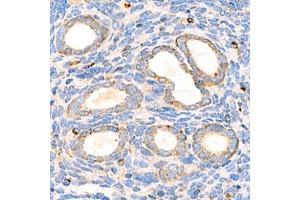 Immunohistochemistry analysis of paraffin-embedded mouse uterus using,Arp2 (ABIN7072895) at dilution of 1: 1500