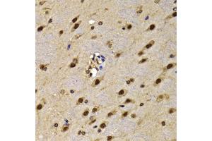 Immunohistochemistry of paraffin-embedded mouse brain using HMG20A antibody (ABIN5974388) at dilution of 1/100 (40x lens). (HMG20A 抗体)