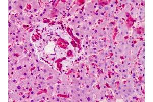 Human Liver: Formalin-Fixed, Paraffin-Embedded (FFPE) (SMO 抗体  (N-Term))