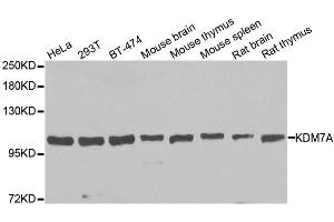 Western blot analysis of extracts of various cell lines, using KDM7A antibody. (JHDM1D 抗体  (AA 417-735))