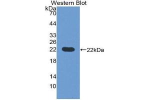 Western Blotting (WB) image for anti-Prepronociceptin (PNOC) (AA 20-176) antibody (ABIN1176128) (PNOC 抗体  (AA 20-176))