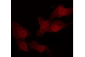 Immunofluorescence (fixed cells) (IF/ICC) image for anti-Matrix Metallopeptidase 14 (Membrane-inserted) (MMP14) (C-Term) antibody (ABIN6263294)