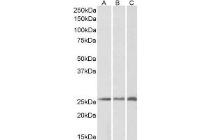 ABIN238612 (0. (CSRP2 抗体  (Internal Region))