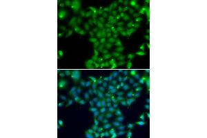 Immunofluorescence analysis of U20S cell using TGM5 antibody. (Transglutaminase 5 抗体)