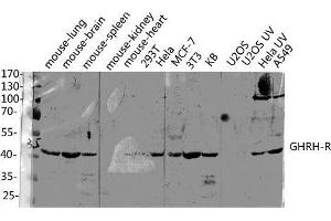 Western Blot (WB) analysis of specific lysis using GHRH-R Polyclonal Antibody. (GHRHR 抗体  (C-Term))