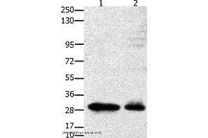 Western blot analysis of 231 cell and mouse testis tissue, using GNRHR Polyclonal Antibody at dilution of 1:2350 (GNRHR 抗体)