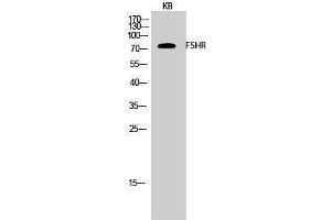 Western Blotting (WB) image for anti-Follicle Stimulating Hormone Receptor (FSHR) (Internal Region) antibody (ABIN3184700) (FSHR 抗体  (Internal Region))