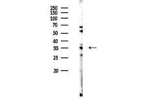 Western blot analysis of lysates from Hela cells(UV 30 min treatment), using OR4C6 Antibody at 1/1000 dilution.