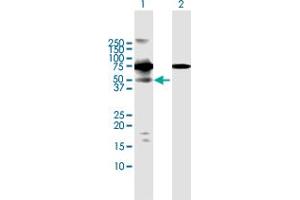 Western Blot analysis of RIOK3 expression in transfected 293T cell line by RIOK3 MaxPab polyclonal antibody. (RIOK3 抗体  (AA 1-519))