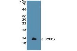 Detection of Recombinant GbA, Human using Polyclonal Antibody to Glucocerebrosidase (GBA) (GBA 抗体  (AA 117-214))