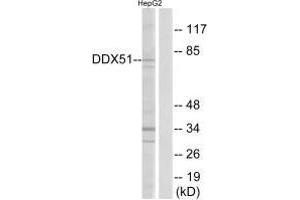 Western blot analysis of extracts from HepG2 cells, using DDX51 antibody. (DDX51 抗体  (C-Term))