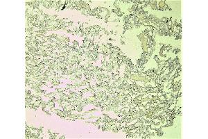 (ABIN184738) Negative Control showing staining of paraffin embedded Human Lung, with no primary antibody.