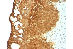 Immunohistochemistry (IHC) image for anti-Keratin 19 (KRT19) antibody (ABIN6939946)