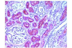 Immunohistochemical analysis of Human L-FABP in Paraffin Embedded Human kidney tissue using FABP1 Antibody Cat. (FABP1 抗体)
