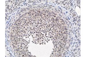 ABIN6264195 and ABIN6266861 at 1/100 staining Rat ovarian tissue by IHC-P. (PIAS1 抗体  (N-Term))