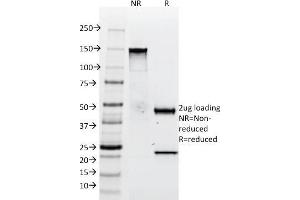 SDS-PAGE Analysis Purified Tenascin C Mouse Monoclonal Antibody (SPM319). (TNC 抗体)