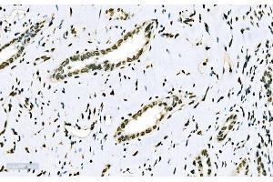 IHC analysis of splicing factor 1 using anti-splicing factor 1 antibody (ABIN7600193). (Splicing Factor 1 抗体  (AA 160-266))