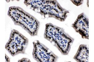 Immunohistochemistry (IHC) image for anti-Nicotinamide phosphoribosyltransferase (NAMPT) (AA 62-337) antibody (ABIN4886677)