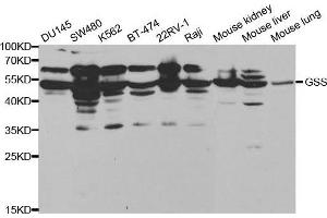 Western blot analysis of extracts of various cell lines, using GSS antibody. (Glutathione Synthetase 抗体  (AA 1-474))