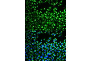 Immunofluorescence analysis of MCF-7 cells using CYP51A1 antibody (ABIN6292369). (CYP51A1 抗体)
