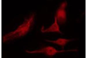 ABIN6268988 staining NIH-3T3 by IF/ICC. (HNRNPK 抗体  (pSer284))