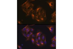 Immunofluorescence analysis of U-2 OS cells using Tubulin beta-1 chain Rabbit mAb (ABIN7271045) at dilution of 1:100 (40x lens). (TUBB1 抗体)