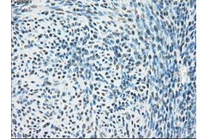 Immunohistochemical staining of paraffin-embedded Ovary tissue using anti-PPP5Cmouse monoclonal antibody. (PP5 抗体)