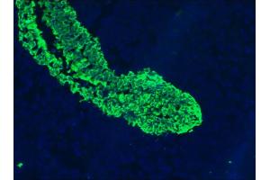 Image no. 3 for anti-Keratin 5/8 (KRT5/8) antibody (ABIN335325) (Keratin 5/8 抗体)