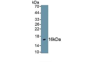 Detection of Recombinant CXCR4, Human using Polyclonal Antibody to Chemokine C-X-C-Motif Receptor 4 (CXCR4) (CXCR4 抗体  (AA 262-352))