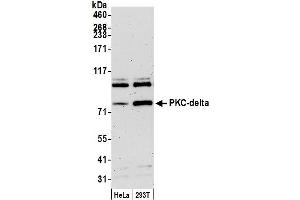 Western Blotting (WB) image for anti-Protein Kinase C, delta (PKCd) (AA 626-676) antibody (ABIN7451961)