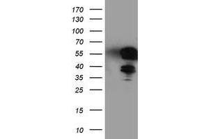 Western Blotting (WB) image for anti-T-Cell Acute Lymphocytic Leukemia 1 (TAL1) antibody (ABIN1501288)