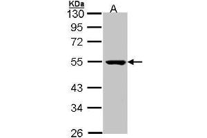 WB Image Sample (30 ug of whole cell lysate) A: Molt-4 , 10 % SDS PAGE antibody diluted at 1:1000 (PSKH1 抗体)