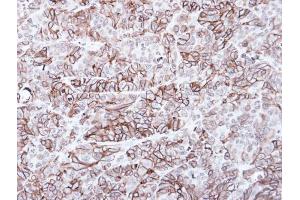 IHC-P Image Immunohistochemical analysis of paraffin-embedded SW480 xenograft, using Frizzled 8, antibody at 1:100 dilution. (FZD8 抗体  (C-Term))