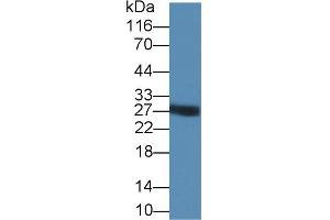 Detection of TRY in PANC1 cell lysate using Polyclonal Antibody to Trypsin (TRY) (Trypsin 抗体  (AA 9-231))