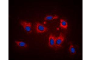Immunofluorescent analysis of LATH staining in K562 cells.