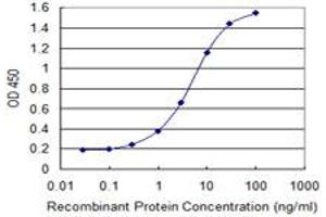 Detection limit for recombinant GST tagged SCEL is 0. (SCEL 抗体  (AA 2-97))