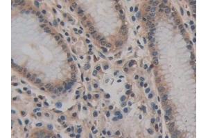 Immunohistochemistry (IHC) image for anti-Basigin (Ok Blood Group) (BSG) (AA 79-280) antibody (ABIN7433759)