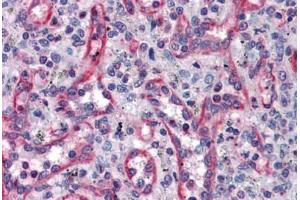 Human Spleen: Formalin-Fixed, Paraffin-Embedded (FFPE) (TUBA4A 抗体  (AA 1-449))