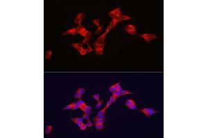 Immunofluorescence analysis of SH-SY5Y cells using BSCL2 antibody (ABIN7265874) at dilution of 1:100. (BSCL2 抗体  (AA 50-150))