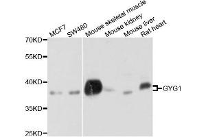 Western blot analysis of extract of various cells, using GYG1 antibody. (Glycogenin 1 抗体)