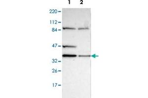 Western blot analysis of Lane 1: Human cell line RT-4; Lane 2: Human cell line U-251MG sp with DSN1 polyclonal antibody  at 1:100-1:250 dilution. (DSN1 抗体)