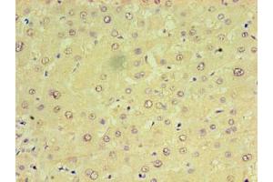 Immunohistochemistry of paraffin-embedded human liver tissue using ABIN7159923 at dilution of 1:100 (CHCHD4 抗体  (AA 1-142))