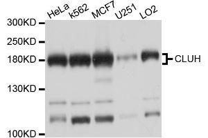 Western blot analysis of extracts of various cell lines, using CLUH antibody (ABIN6003838) at 1/1000 dilution. (CLUH 抗体)