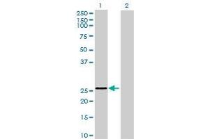 Lane 1: ELA1 transfected lysate ( 27. (ELA1 293T Cell Transient Overexpression Lysate(Denatured))