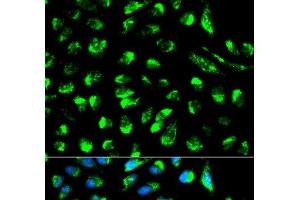 Immunofluorescence analysis of HeLa cells using ECI1 Polyclonal Antibody (DCI 抗体)